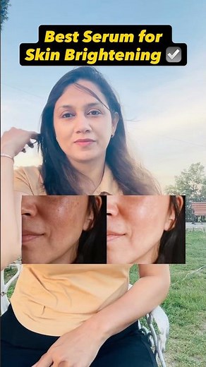 🔥 Best Serum for Dark Spots & Skin Brightening | Remove Pigmentation Fast?