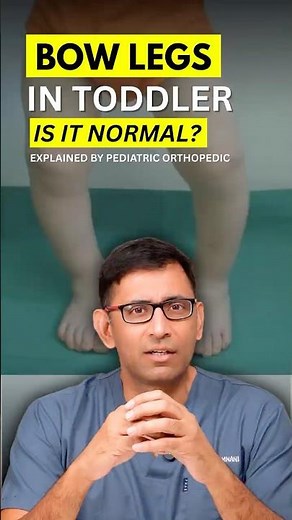 Bow legs in toddlers When is it normal | Dr. Kirti Ramnani