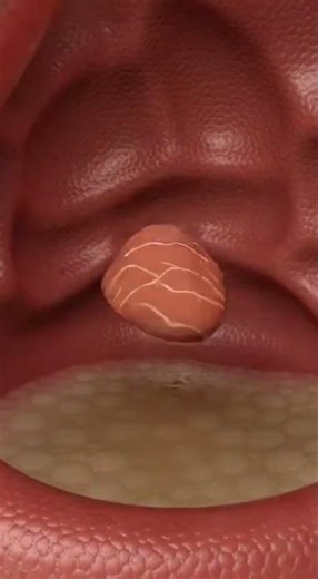 “What Happens When You Eat Fish? (Inside Human Body Animation)”fish digestion, fish inside