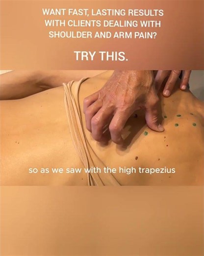 Shoulder & Arm Pain: Stop Treating Just the Scapula!