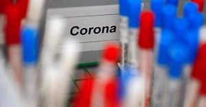 Lviv launches high accuracy antibody testing, using ELISA method