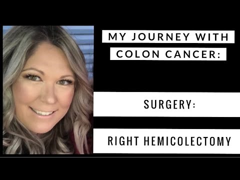 My Journey With Colon Cancer - Episode #3 - Colon Resection Surgery