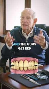 Healthy gums should not bleed even when we probe them 🩸