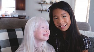 3.1K views · 86 reactions | For Martha and Bob Bonneau, albinism and their daughters’ other special needs have been the least challenging part of their adoption experience. The hard part has required them to learn a few new parenting strategies — and their daughters to learn just how strong and proud they can be. Learn more about adoption: holtinternational.org/adoption | Holt International | Facebook