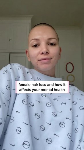 female hair loss and how it affects your mental health #learnontiktok #thyself #thywellness #femalehairloss