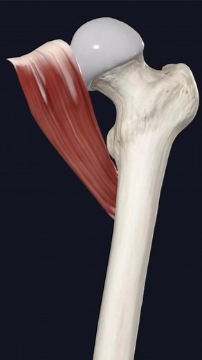 Pectineus Muscle. Origin: The pectineus muscle originates from the superior pubic ramus, adjacent fascia. Insertion: The fibres of the pectineus muscle travel inferolaterally and insert, via a broad tendon, onto the pectineal line of the femur. The pectineus muscle is found in the medial compartment of the thigh; however due to its innervation and actions, it can also be considered a muscle of the anterior compartment of the thigh. It is a short flat quadrilateral type of skeletal muscle. #anato