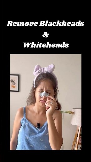 How to remove blackheads from nose using charcoal strip 🫰 #blackheadsnoseremoval #blackheadsremove