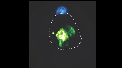An exciting discovery from UCSF and Cedars-Sinai researchers could be the first step toward growing human organs from scratch, a long-time goal of regenerative medicine! They identified cells that can be programmed to prompt other stem cells to form rudimentary, organ-like structures — including one that contracts like a beating heart. "These engineered 'organizer' cells could someday enable us to repair and replace organs in the patients (who) need it," UCSF's Wendell Lim says. Learn more ➡️ ht