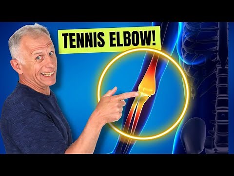 How to Fix Tennis Elbow! (3 Easy Steps)