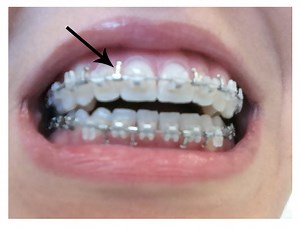 How To Use Wad Files