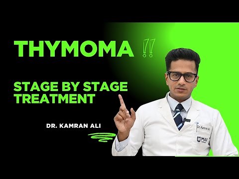 Thymoma || Stage by Stage Treatment of Thymoma