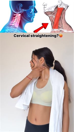 Anjali Yadav ✨ on Instagram: "Releasing the sternocleidomastoid muscle is essential for cervical straightening. Its shortening causes the head to jut forward, increasing tension in the neck and contributing to symptoms such as neck pain, dizziness, or vertigo. Releasing it reduces pressure and restores postural balance. #anjalifitness . . . . #cervicalstraightening #neckpain #chronicpain #dizziness #fitness #wellness #explore #reels"