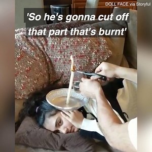 888K views · 864 reactions | This is how you remove wax from your ear with a candle  | Daily Mail Video | Facebook