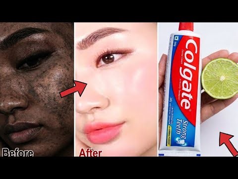 বাড়িতে রাখা Colgate দিয়ে মুখ glowing করুন /Colgate toothpaste for face whitening|Lemon and colgate