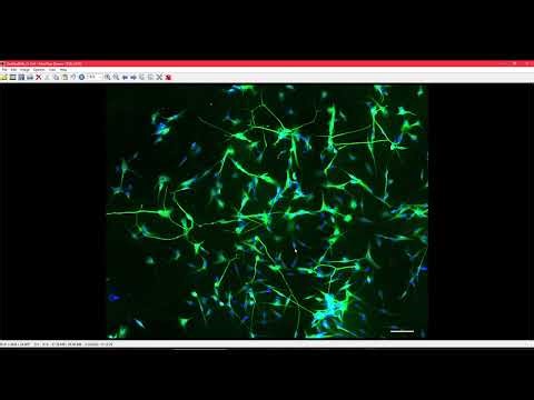How to select a region of interest and burn the scale bar using ZEN lite #zeiss #ZENlite #microscope