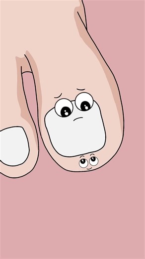 Why Do You Get Paronychia Around Your Nails #animation #healthcare