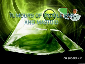 TUMOURS OF MIDDLE EAR AND MASTOID - SlideServe