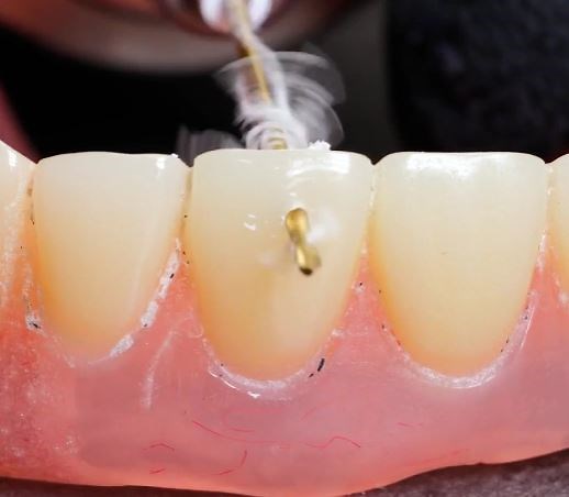 How to Make Your Teeth the Star | 5-Minute Crafts