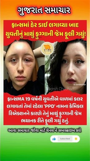 #motivation #omg​ #trending​​ #shorts​ #gujaratinews #samachar