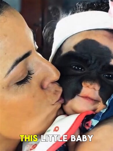 Strange Birthmark Leads to Shocking Discovery