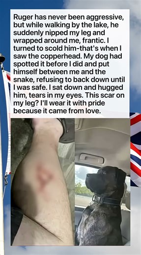 Dog's Heroic Warning Bite Saved My Life