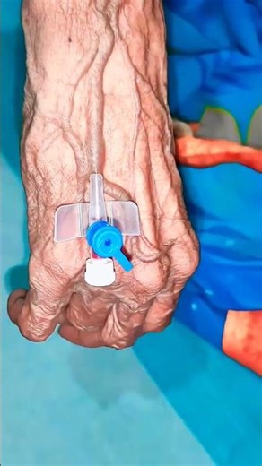 IV Cannulation Fixing process#hospital #doctor #trending #nursing #medical #bscnursing #doctorlife