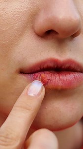 9.7M views · 258 reactions | 26 TRUCOS DE BELLEZA INVALUABLES PARA TU PIEL: | Genial | Facebook