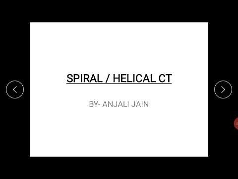 Spiral CT Scan