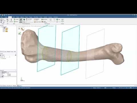 SpaceClaim Skin Surface Tool for Reverse Engineering
