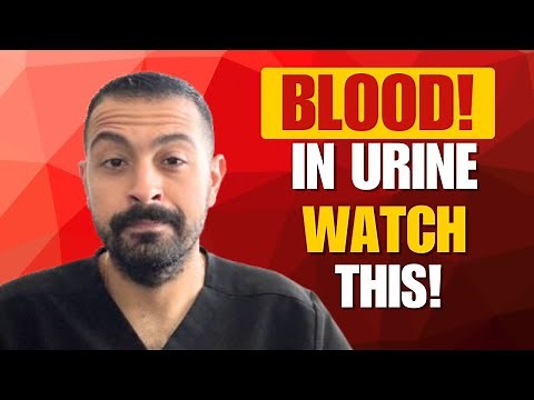 Hematuria: Causes Of BLOOD In the Urine And Management!