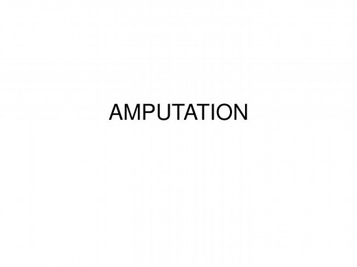 AMPUTATION - SlideServe