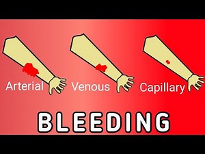 Arterial, Venous, and Capillary Bleeding – What’s the Difference?