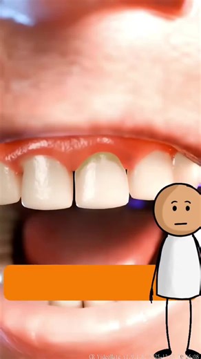 #facts #mindblown #interestingfacts_done332