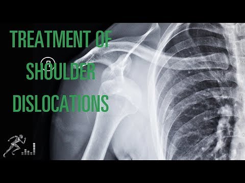 Shoulder dislocation: Initial management and treatment