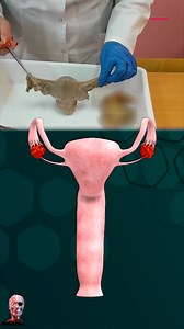 1M views · 6.8K reactions | Reality vs. Fantasy: The Uterus Showdown...