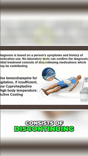 Serotonin-Syndrom: Diagnose, Behandlung & Symptome verstehen #shorts