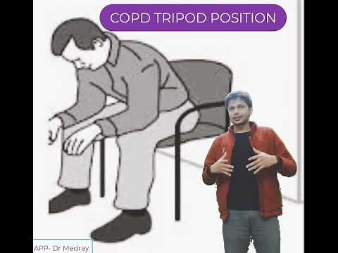 Tripod Position in COPD Explained