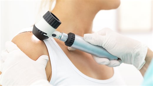 Podezřelá piha? Tohle může být rakovina kůže – Dáma.cz