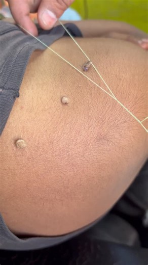 Jeetu mens salon on Instagram: "Massa nikala bina nisan ke #massa by @jeetu_mens_salon #massage #massa #mässa #massamagra #massaartesanal #massamuscular #massafm #massachussets #massafresca #dot #kil #dots #reels #reelsinstagram #instagood #viral #foryou #love #instagram #tiktok"