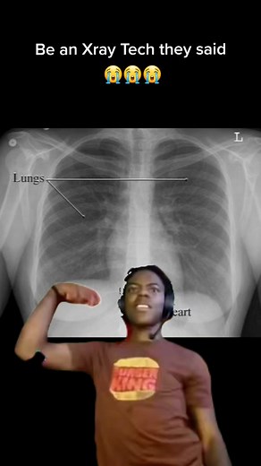 Xray Girl Creations on TikTok