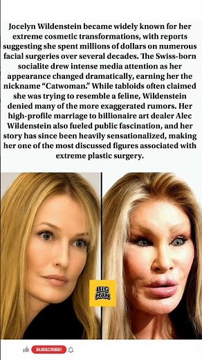 Jocelyn Wildenstein and the Story Behind Her Dramatic Transformation #Catwoman #PlasticSurgery