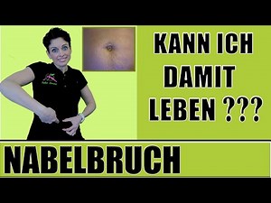 Kann ich mit einem Nabelbruch leben? #8 Umbilikalhernie nach Schwangerschaft Operation Maike Droste