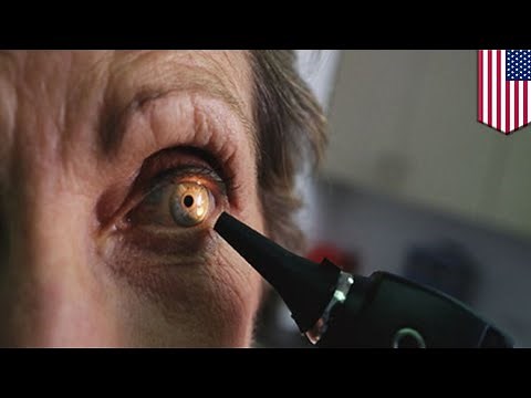 Eclipse eye damage: Woman gets crescent-shaped eye burn after staring at solar eclipse - TomoNews