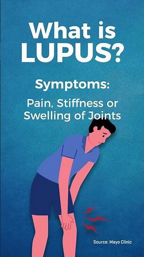 How Lupus Actually Works