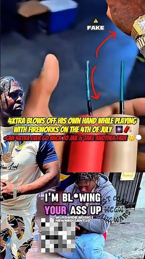 4xtra blows his hand off with a firework on 4th of July 🥳🇺🇸 #4xtra #nojumper #losangeles #cali