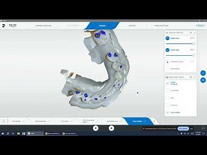 Making Screw Retained Crown on TiBase
