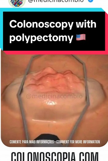 Medicinacombio no TikTok