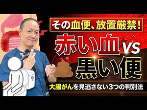 【血便の種類】お尻から血が出たら確認すべき3つのポイント。赤い血と黒い便、大腸がんの可能性は？消化器内科医が解説