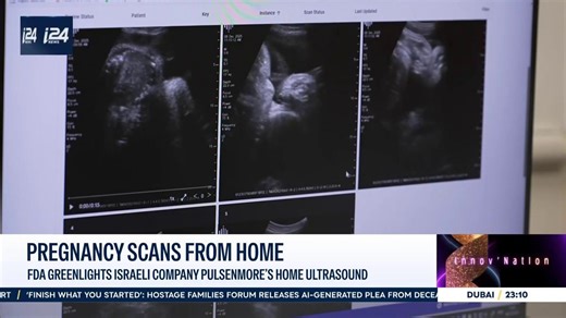 FDA approves Israeli company Pulsenmore's at-home ultrasound device in the US