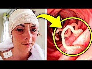 Woman Hears Noises in Her Head for Years So Doctors Discover the Truth